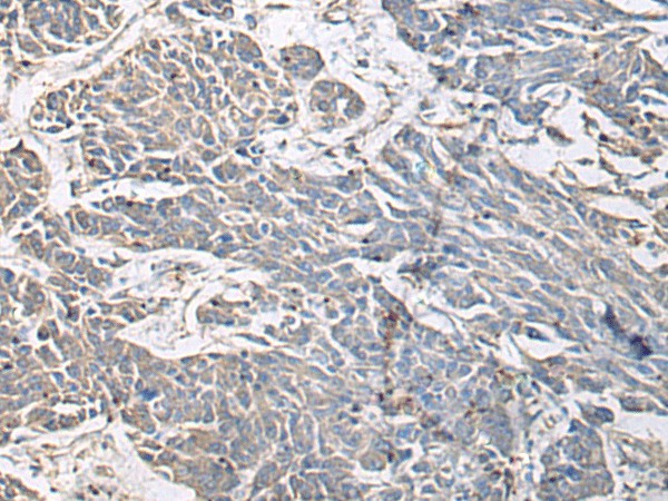 PRKCSH Polyclonal Antibody (E-AB-19271)