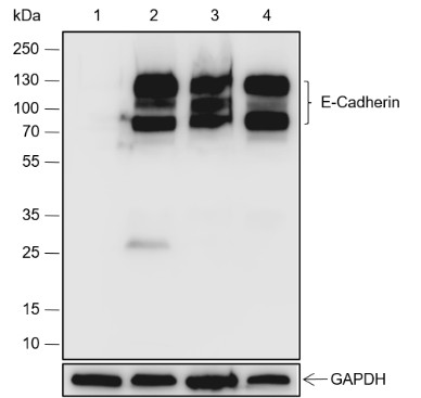 Recombinant E-Cadherin Monoclonal Antibody (AN301701L)