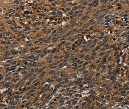 PCDHB15 Polyclonal Antibody (E-AB-16692)