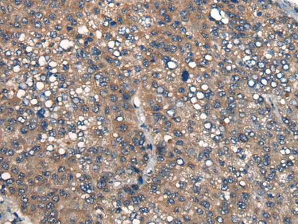 ICMT Polyclonal Antibody (E-AB-19713)