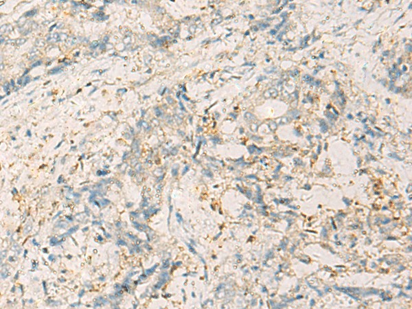 WDR37 Polyclonal Antibody (E-AB-19207)