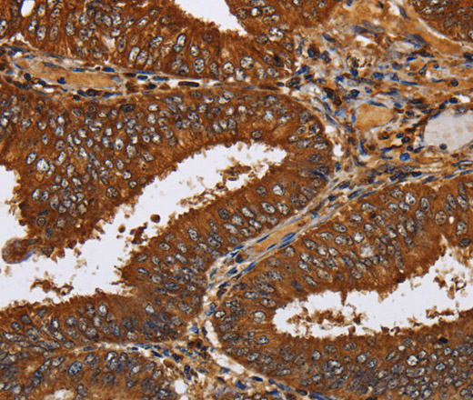 TICAM2 Polyclonal Antibody (E-AB-15119)
