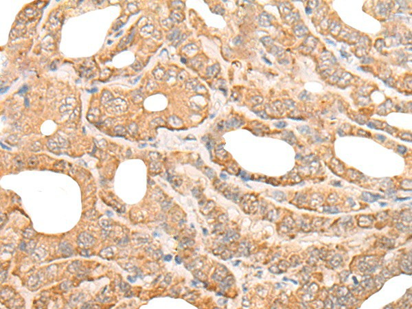 DEF8 Polyclonal Antibody (E-AB-52580)