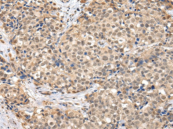 TBL1X Polyclonal Antibody (E-AB-17052)