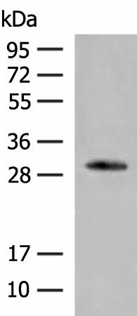 VDAC3 Polyclonal Antibody (E-AB-52229)