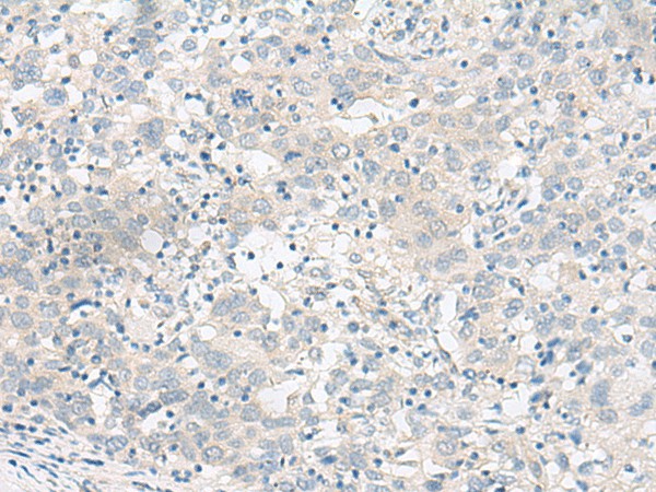 RALGAPA1 Polyclonal Antibody (E-AB-17987)