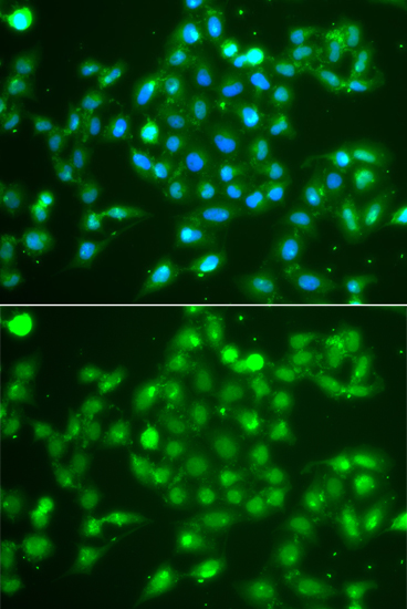 UCHL5 Polyclonal Antibody (E-AB-62446)