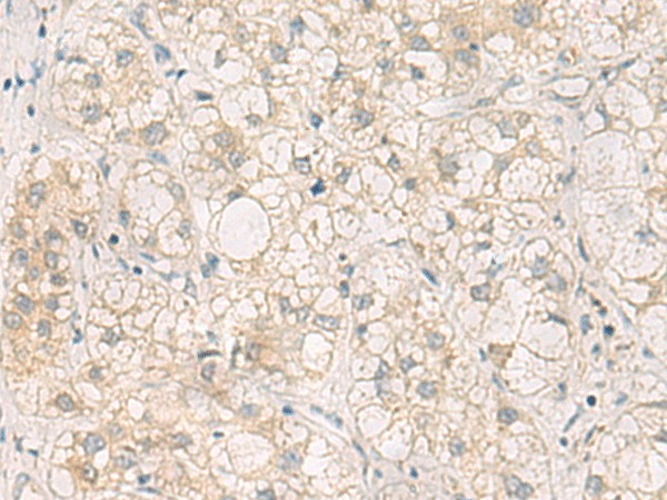 LRAT Polyclonal Antibody (E-AB-53099)