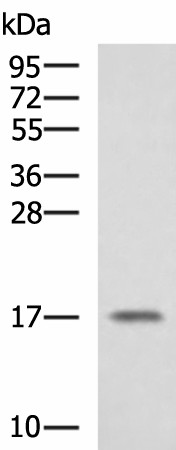 SRP14 Polyclonal Antibody (E-AB-52215)