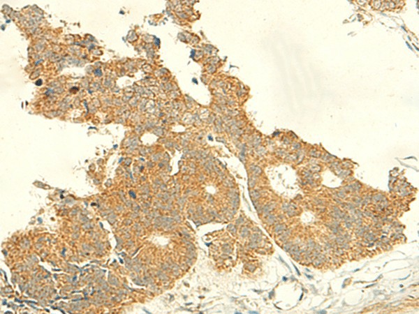 IFT27 Polyclonal Antibody (E-AB-52838)