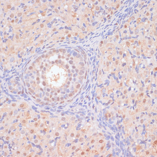 BYSL Polyclonal Antibody (E-AB-65860)