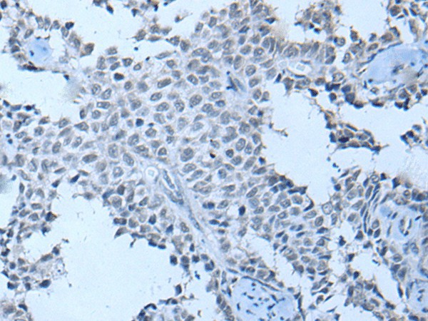 ZNF703 Polyclonal Antibody (E-AB-19556)