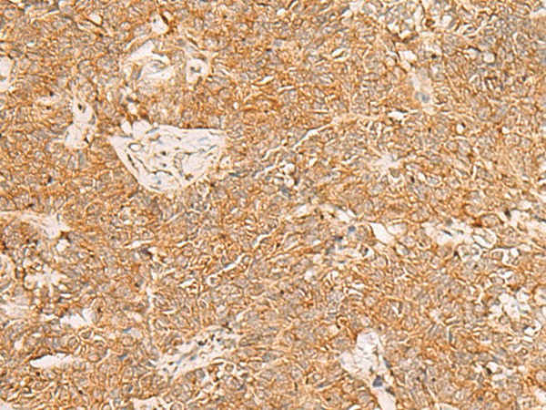 PDCD4 Polyclonal Antibody (E-AB-18246)