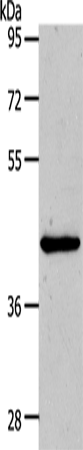 MMP13 Polyclonal Antibody (E-AB-10064)