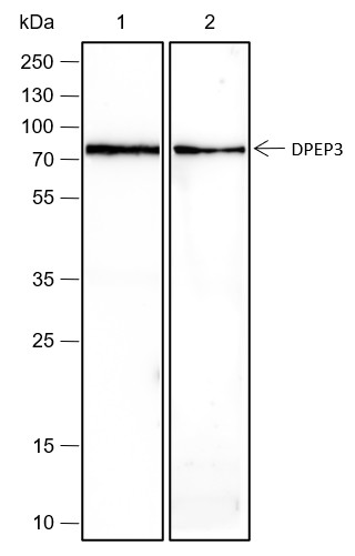 Recombinant DPEP3 Monoclonal Antibody (AN301721L)
