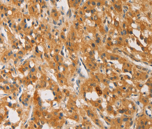 ATG4D Polyclonal Antibody (E-AB-14636)