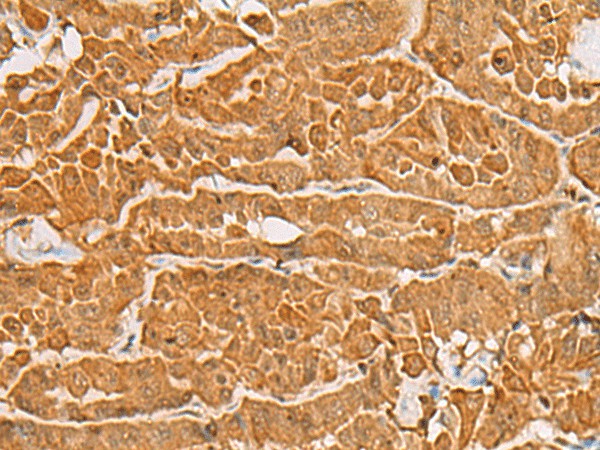 MAPK14 Polyclonal Antibody (E-AB-18245)