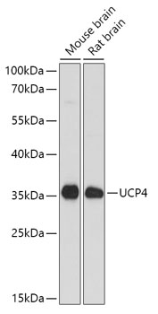SLC25A27 Polyclonal Antibody (E-AB-66143)