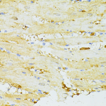 SIRT2 Polyclonal Antibody (E-AB-64253)