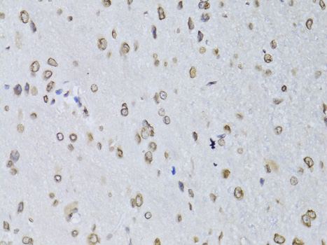 LMNB2 Polyclonal Antibody (E-AB-61994)