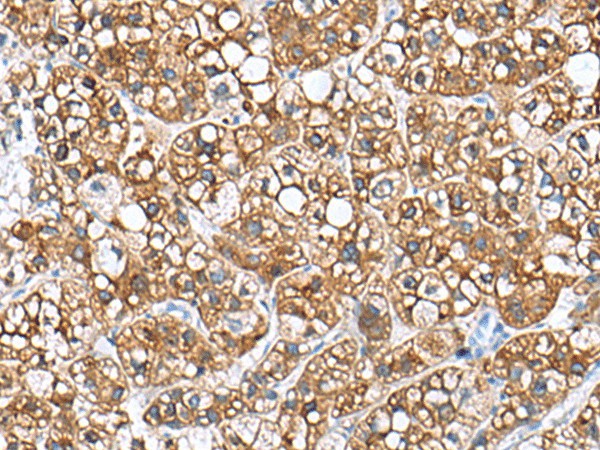 PHLDA3 Polyclonal Antibody (E-AB-19111)