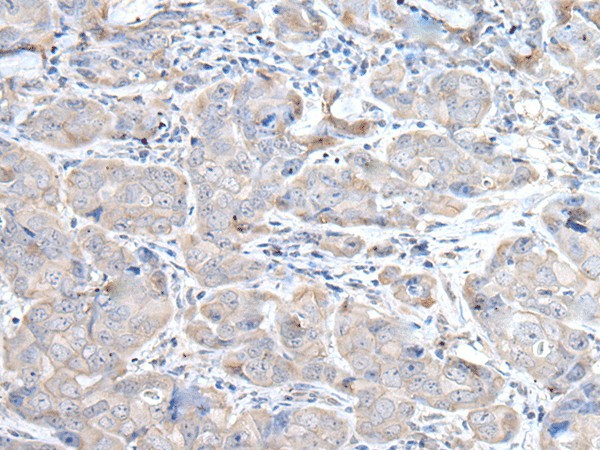 RASA1 Polyclonal Antibody (E-AB-52205)