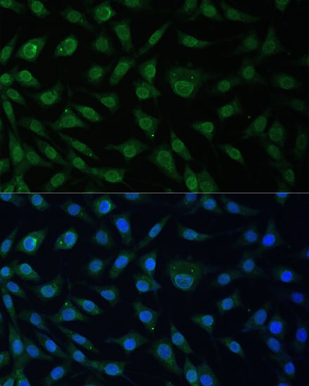 NUP214 Polyclonal Antibody (E-AB-67980)