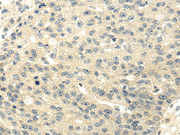 GAD1 Polyclonal Antibody (E-AB-17390)