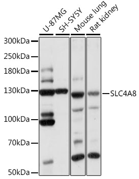 SLC4A8 Polyclonal Antibody (E-AB-90963)