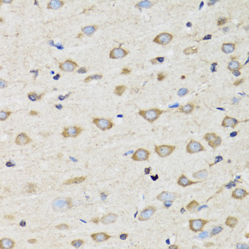 CLIC4 Polyclonal Antibody (E-AB-61517)