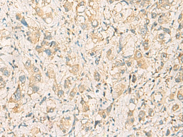 F11R Polyclonal Antibody (E-AB-19216)
