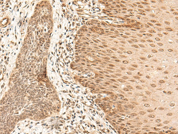 ARMC8 Polyclonal Antibody (E-AB-18698)