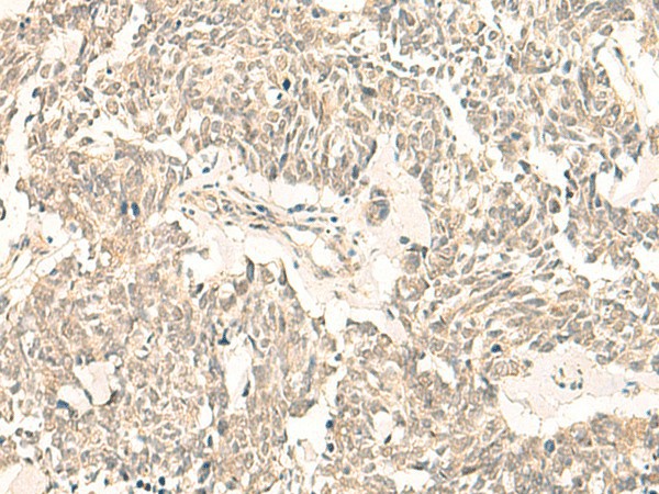 GINS2 Polyclonal Antibody (E-AB-52836)