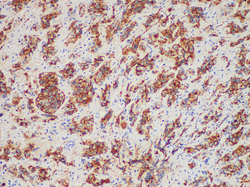 PRL Monoclonal Antibody (ELAB6484-M)
