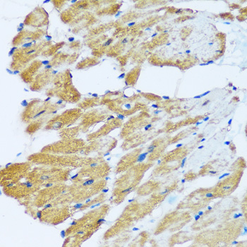 ARHGEF5 Polyclonal Antibody (E-AB-67020)