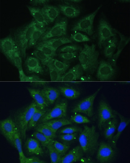 IGF2BP2 Polyclonal Antibody (E-AB-65382)