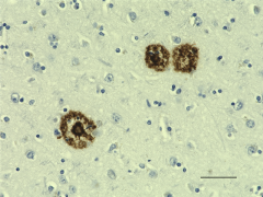 Biotin anti-β-Amyloid, 1-42 (Previously Covance catalog# SIG-39144) (805504)