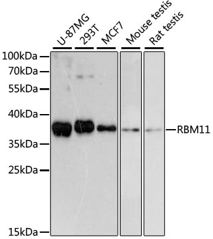 RBM11 Polyclonal Antibody (E-AB-64507)