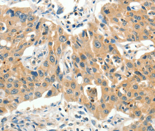 SLC11A2 Polyclonal Antibody (E-AB-16394)