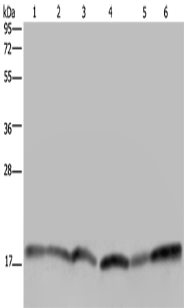 RHEB Polyclonal Antibody (E-AB-16645)