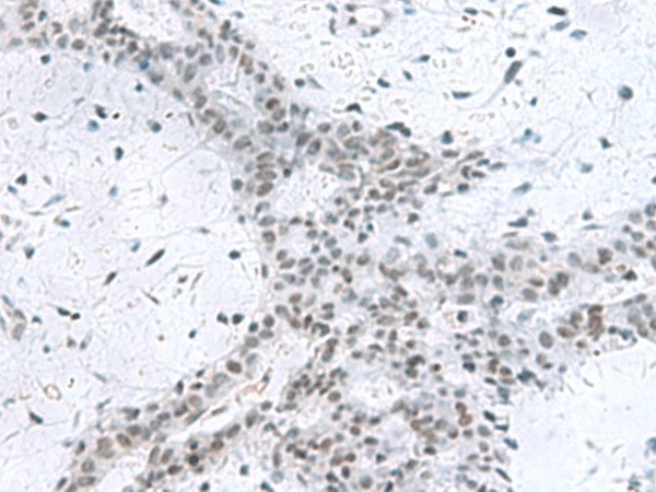 PCLAF Polyclonal Antibody (E-AB-52100)