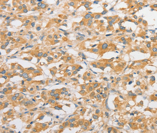 TLR5 Polyclonal Antibody (E-AB-10872)