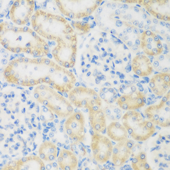NAT8B Polyclonal Antibody (E-AB-61582)