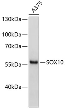 SOX10 Polyclonal Antibody (E-AB-68003)