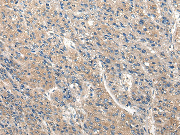 CLIC6 Polyclonal Antibody (E-AB-19712)