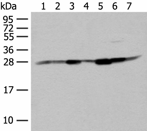 NIPSNAP2 Polyclonal Antibody (E-AB-19832)