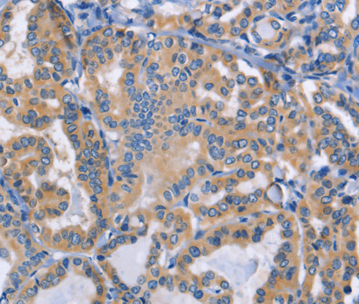 DOK4 Polyclonal Antibody (E-AB-10910)