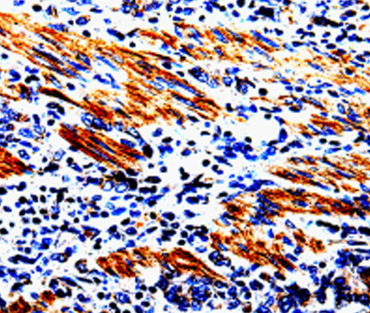 ACSBG2 Polyclonal Antibody (E-AB-10021)