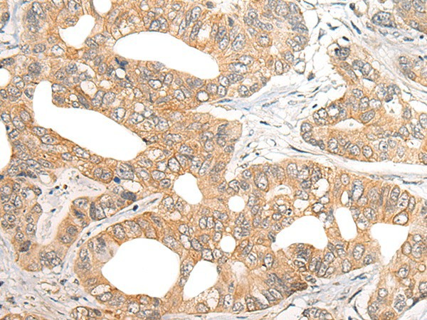 SNX6 Polyclonal Antibody (E-AB-17861)
