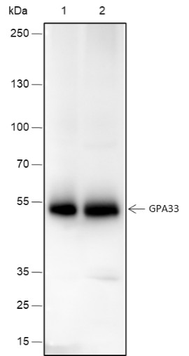 Recombinant GPA33 Monoclonal Antibody (AN301539L)